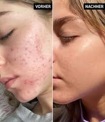 سرم نیاسینامید اینکی لیست Inkeylist حجم 30 میلی لیتر