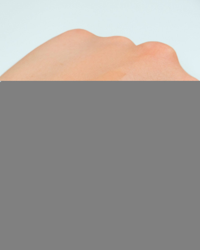 اسنس آبرسان و لوشن درمانی رووکتین