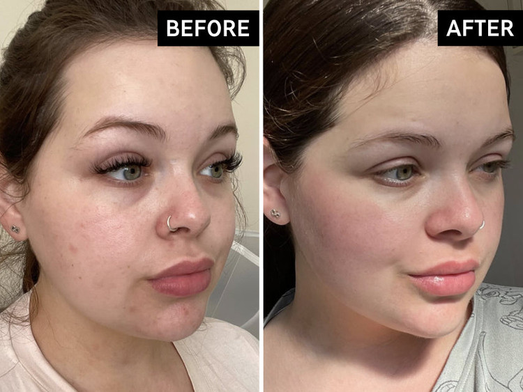 کرم آبرسان و مرطوب کننده صورت امگا واتر اینکی لیست