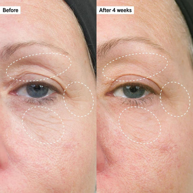 مرطوب کننده ترمیمکننده و حجمدهنده سرامید بایو-اکتیو اینکی لیست