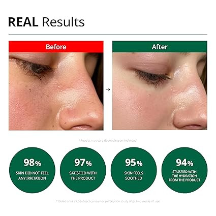 کرم مرطوب کننده و تسکین دهنده دکتر جی برای پوست های حساس و آسیبدیده