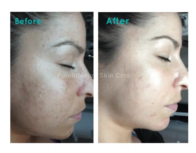 سرم شب اصلاحکننده پیگمنتیشن ماندلیک اسید الیز آو اسکین