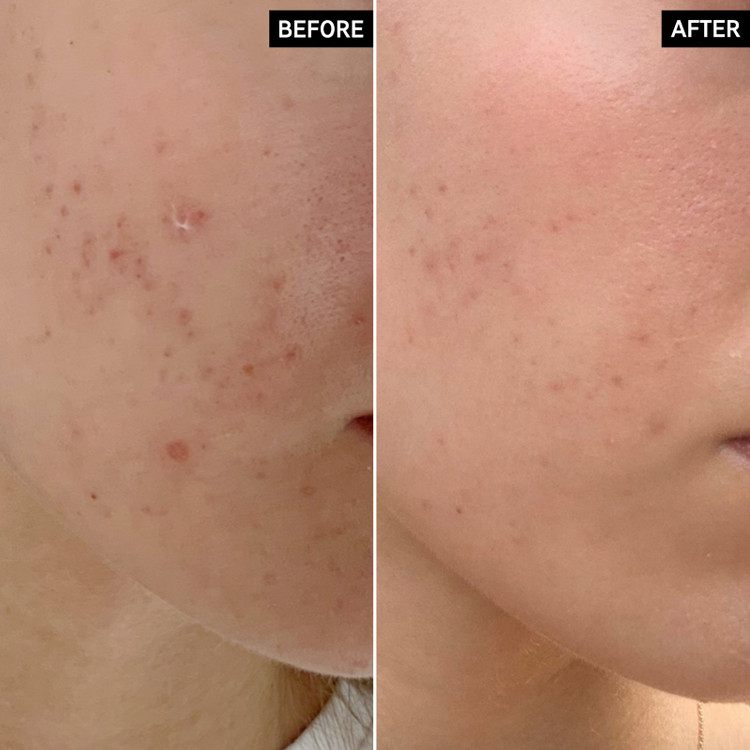 سرم شب اصلاحکننده پیگمنتیشن ماندلیک اسید الیز آو اسکین