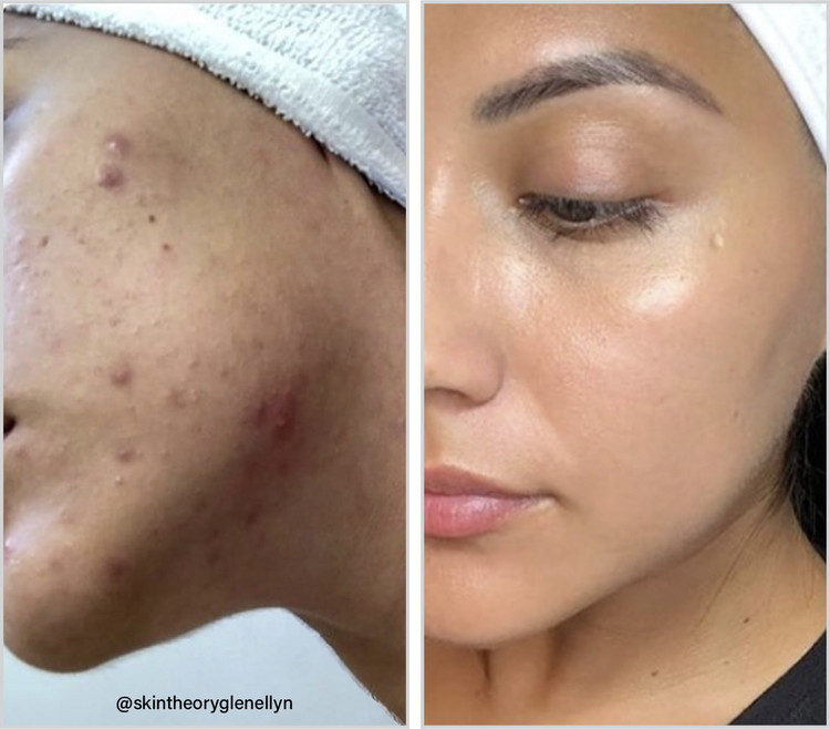 سرم شب اصلاحکننده پیگمنتیشن ماندلیک اسید الیز آو اسکین